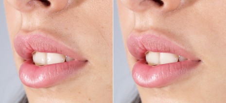 Pincel Corrector Puntual Photoshop